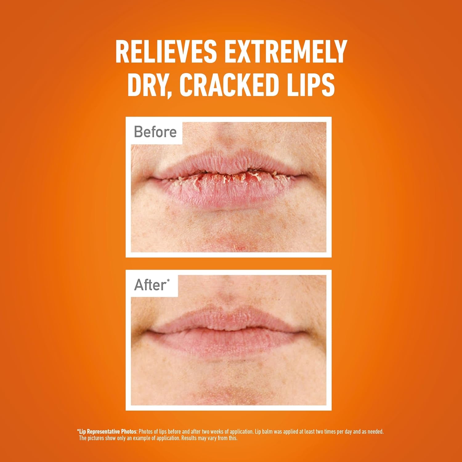 Lip Repair Unscented Lip Balm, 4.2G – for Extremely Dry, Cracked Lips | All-Day Moisture with 7 Moisturising Ingredients