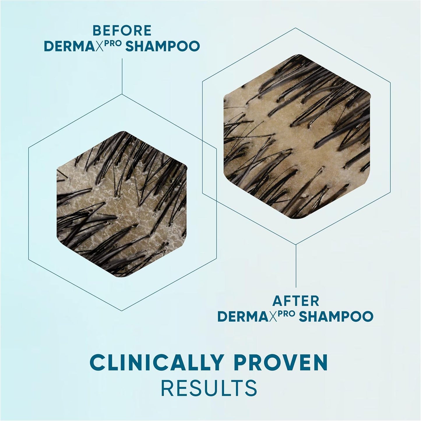 Dermaxpro Repairing Moisture anti Dandruff Shampoo 500Ml +  Dermaxpro Repairing Moisture Lightweight Conditioner 350 Ml