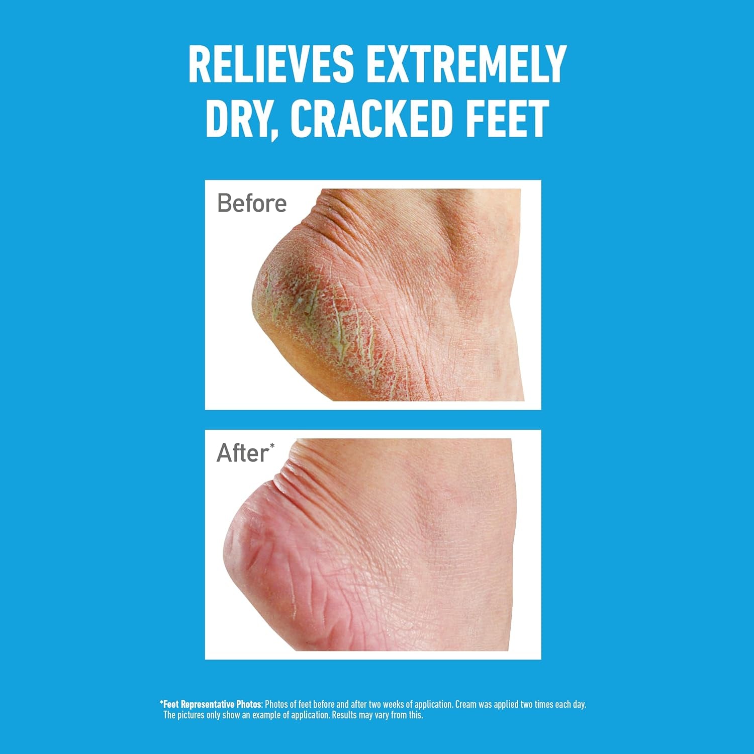Healthy Feet Jar 91G - Foot Cream for Very Dry Skin, Cracked Heels and Feet | Instantly Boosts Moisture Levels, Creates a Protective Layer & Prevents Moisture Loss