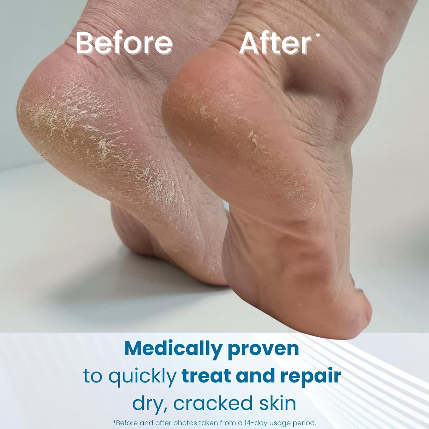 Heel Balm, 4 Oz Tube: Rich Moisturizing and Exfoliating Foot Cream for Rough, Dry, and Cracked Skin.