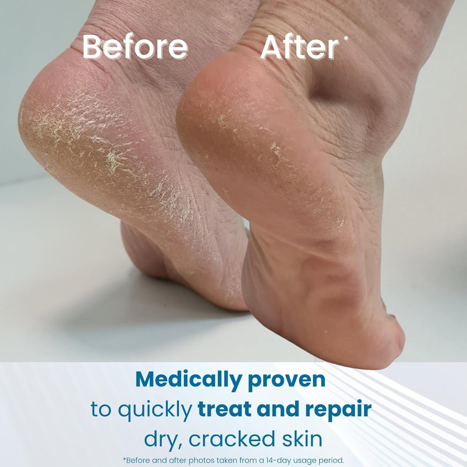 Heel Balm, 4 Oz Tube: Rich Moisturizing and Exfoliating Foot Cream for Rough, Dry, and Cracked Skin.