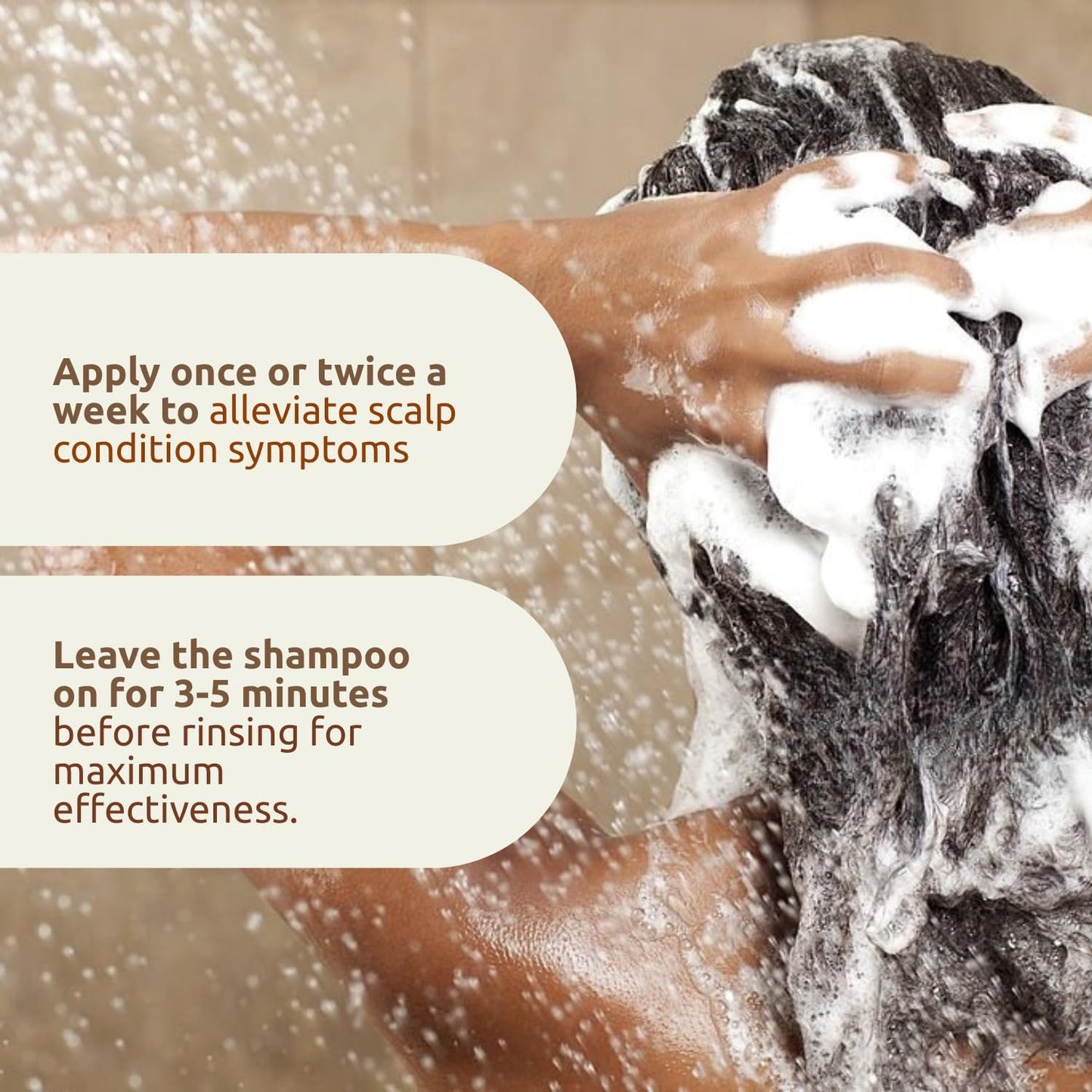 Scalp Shampoo, for Scalp Conditions, Reduces Itching, Inflammation and Scales, Shampoo Treats Psoriasis, Seborrhoeic Dermatitis, Eczema and Dandruff, Contains Coal Tar Solution, 1 X 150Ml